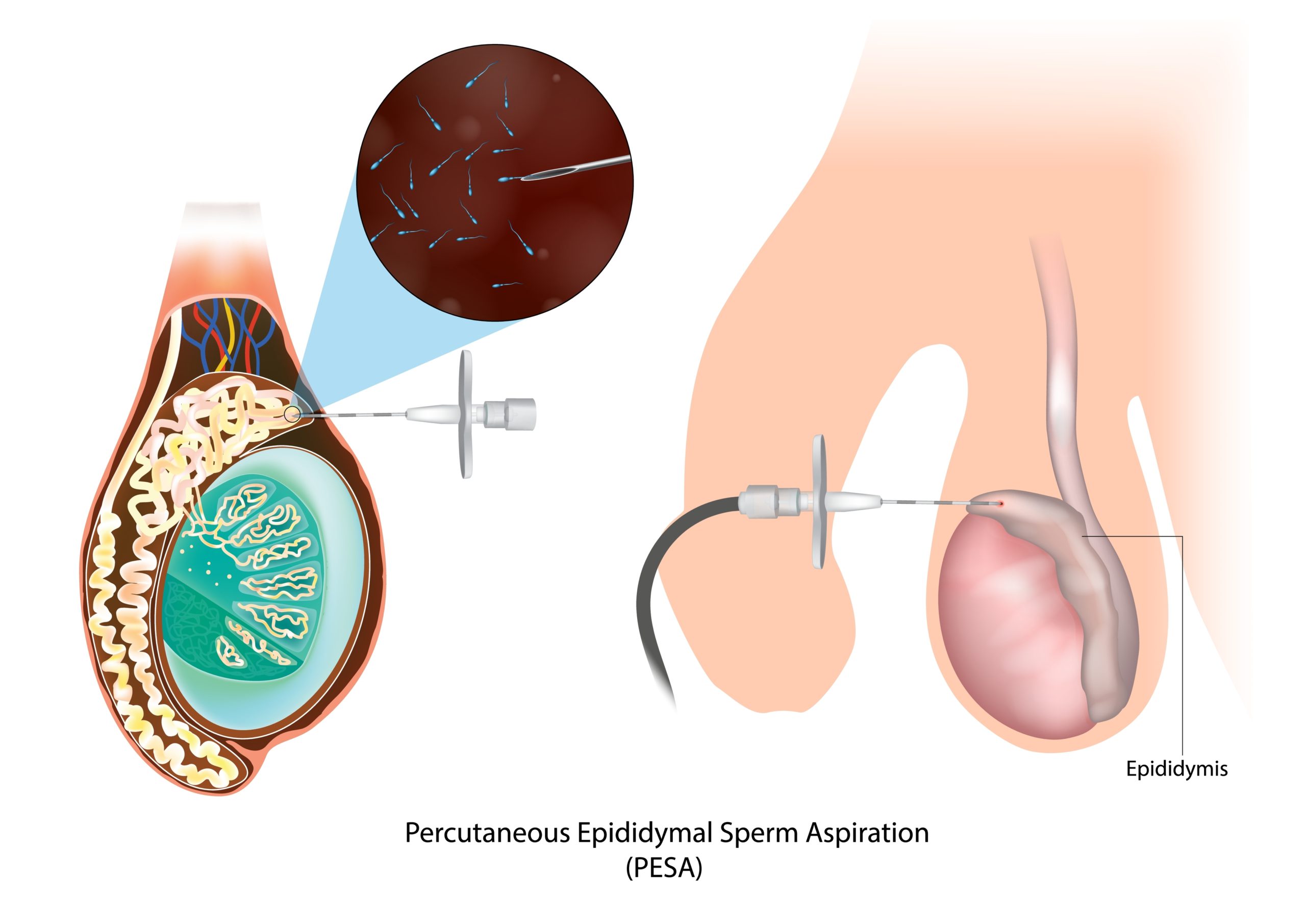 Gillian Andersonning Kanadadagi ogzaki jinsiy aloqa chempionati